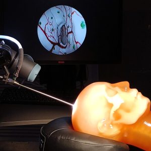 A robot arm with a neuroendoscope positioned in relation to a human head “phantom” for the experimental validation of an augmented neuroendoscopy system.