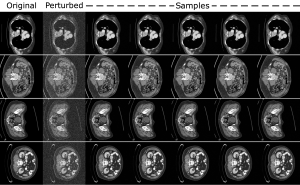 Abdominal scans in a 7 by 4 grid. The first column is labeled "Original." The second column is labeled "Perturbed." The remaining five columns are labeled "Samples."